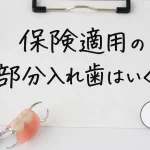 保険適用の部分入れ歯はいくら？値段・見た目・耐久性を自費と比較